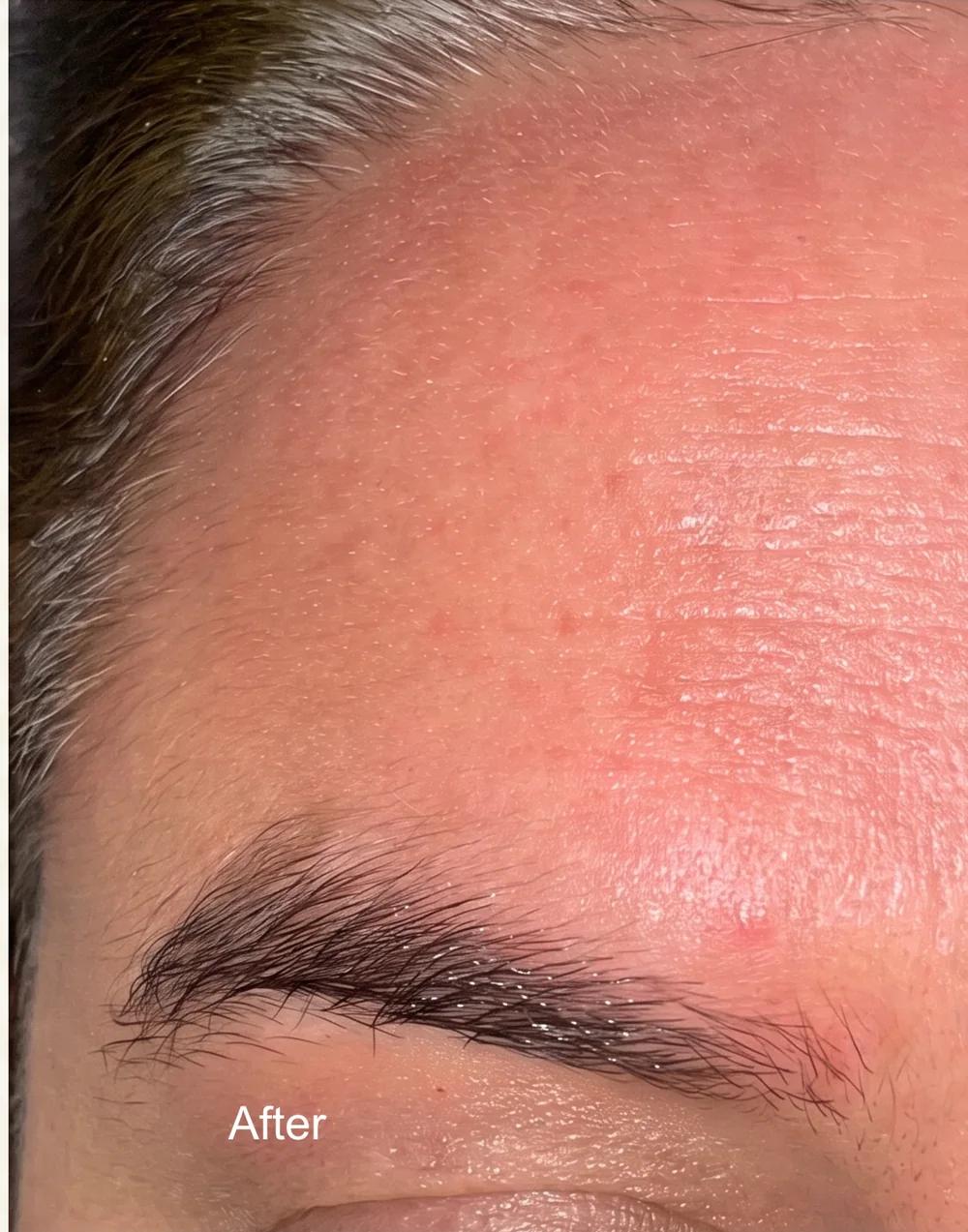 The same client’s pigmentation after treatment