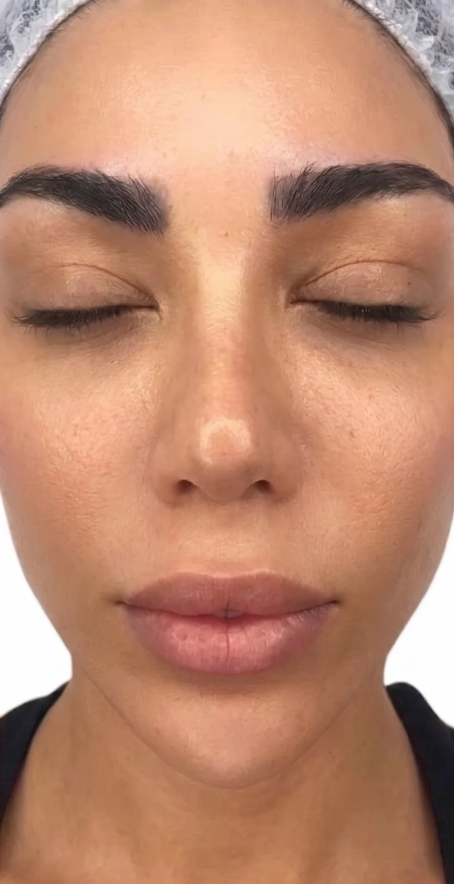 The same client’s skin after treatment